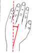 Handgelenk radial